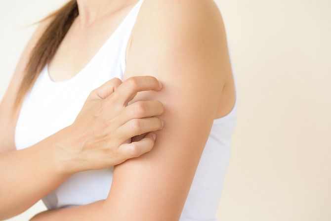 自宅の手によってかゆみを女性の腕の傷を閉じます。健康・医療のコンセプトです。