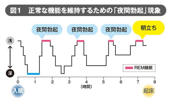 朝立ち がなくなったらed 毎日の現象が示す真の意味 President Online プレジデントオンライン