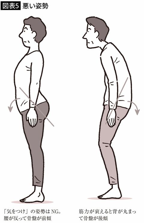 【図表5】悪い姿勢