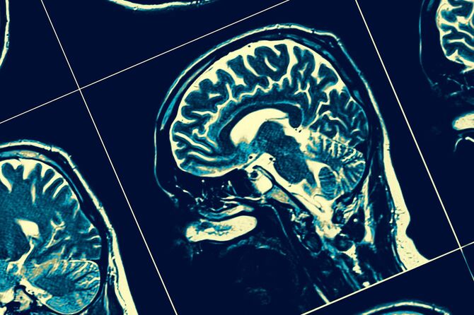 頭部のレントゲン写真