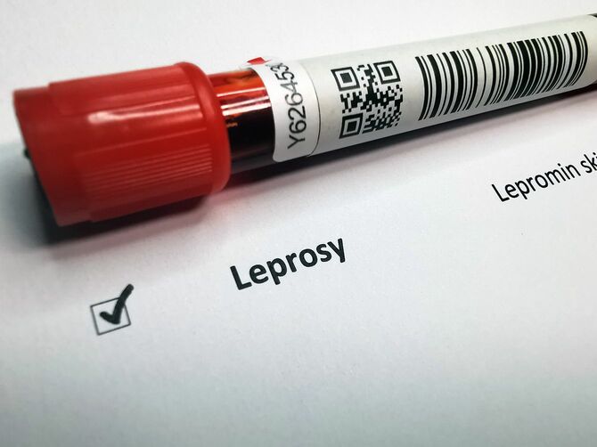 ハンセン病血液検査