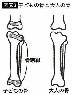 【図表3】子どもの骨と大人の骨