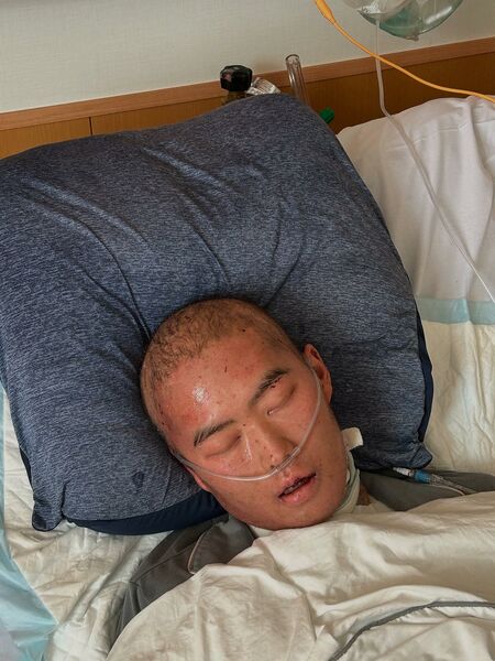 樺嵯斗さん 病室