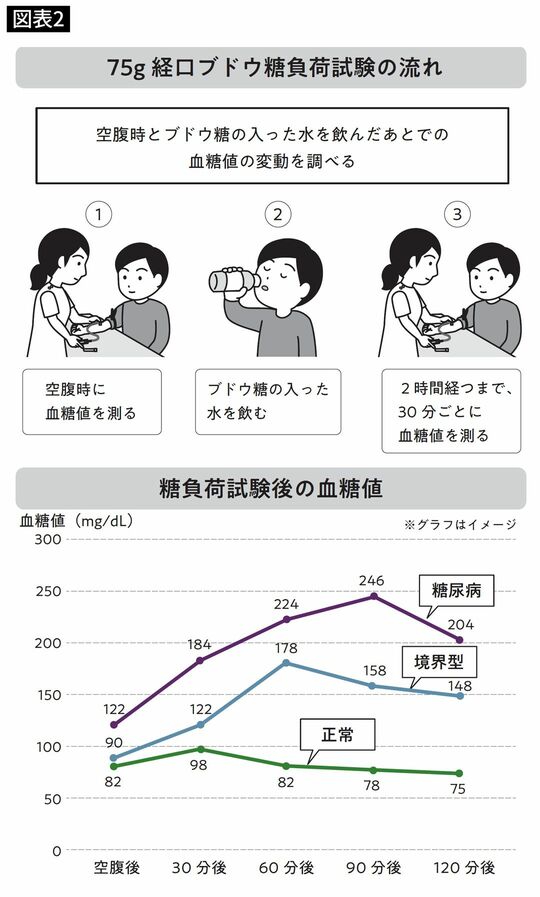 75g経口ブドウ糖負荷試験の流れと糖負荷試験後の血糖値