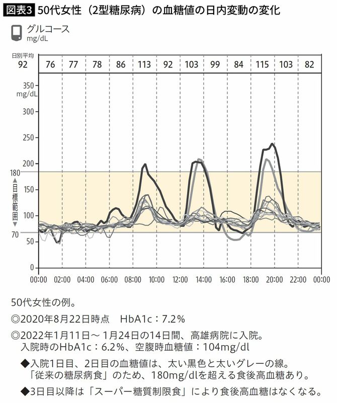 50代女性（2型糖尿病）の血糖値の日内変動の変化